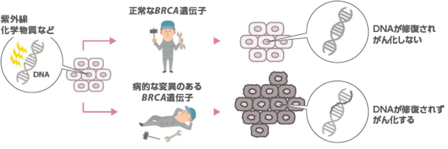 DNA修復の仕組みとBRCA遺伝子 | BRCA1/2遺伝子について | 遺伝性乳がん | 乳がん.jp