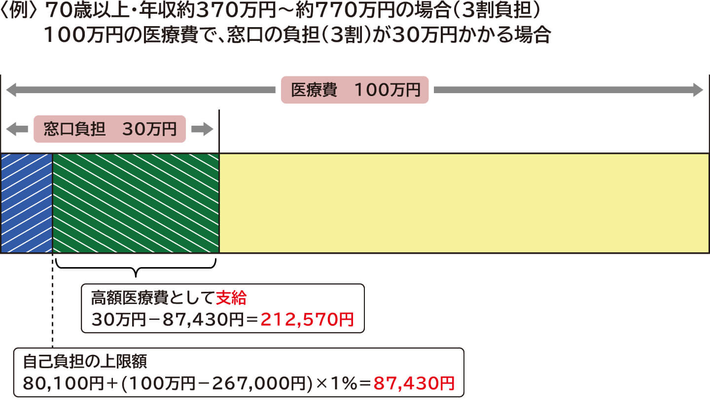 69歳以下のかたの自己負担上限額の計算方法、高額療養費制度について | 乳がん患者さんのライフサポート | 乳がん.jp