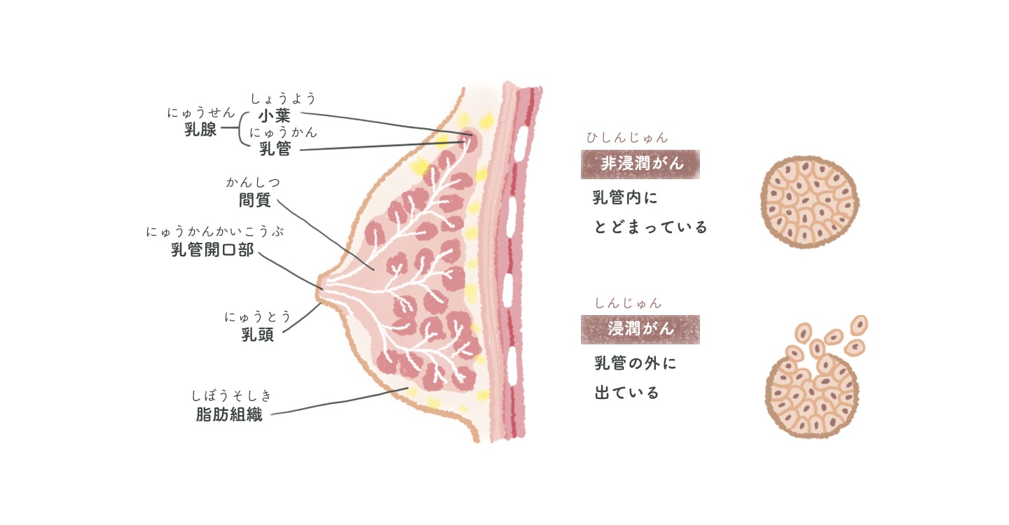 乳房のしくみと乳がん | 乳房のしくみとがんの発生 | 乳がんの基礎知識 | 乳がん.jp